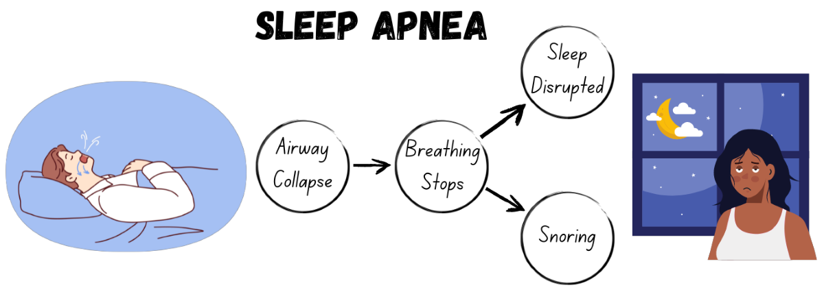 Sleep apnea diagram: (left) person with obstructed airway during sleep, (middle) airway collapse leads to breathing stops leads to sleep disrupted and snoring text, (right) tired woman in front of window in the middle of the night