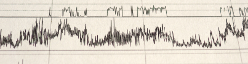 graph of activity levels while wearing an actigraphy device